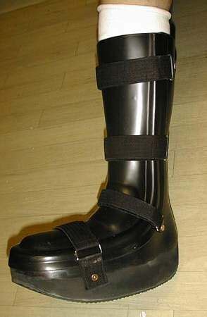 CROW (Charcot Restraint Orthotic Walker) | Orthotics, Boots, Arch ...