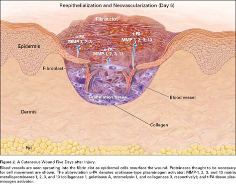 Improved Dermal Wound Healing - Wound Healing