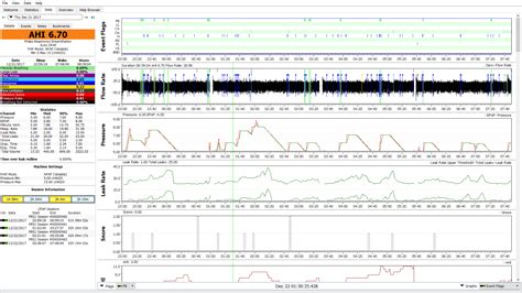 Need Advice on Auto CPAP Settings | Apnea Board