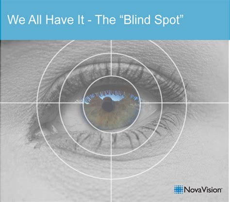 We All Have It – The “Blind Spot” – NovaVision