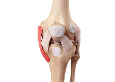 Medial Patellofemoral Ligament Injury |MPFL | Orthopedic Knee ...