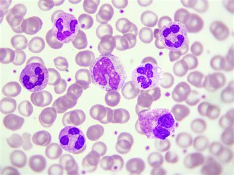 What Are Leukocytes? Types of Leukocytes