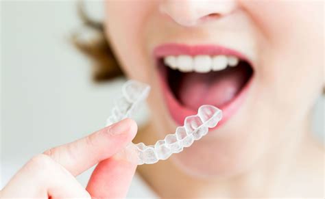 Consejos para la limpieza y cuidado de los alineadores de Invisalign ...