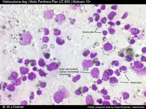 What Is A Histiocytoma On A Dog