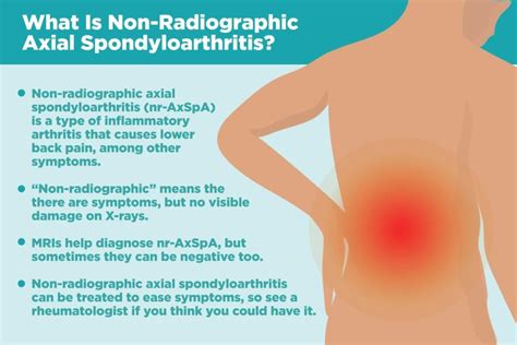 What Is Non-Radiographic Axial Spondyloarthritis (nr-AxSpA)?