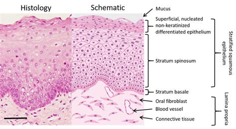 Keratinized Gingiva Histology