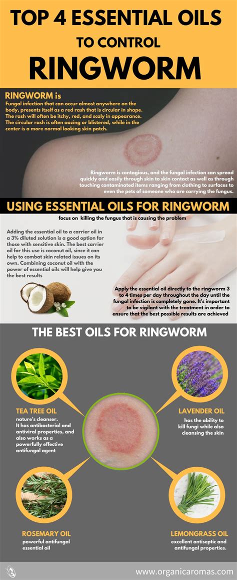 What Is Ringworm And How To Treat It Naturally Jennifer Thompson | Porn ...