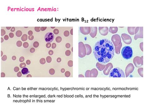 Lab 2: Blood Pathologies - ppt download