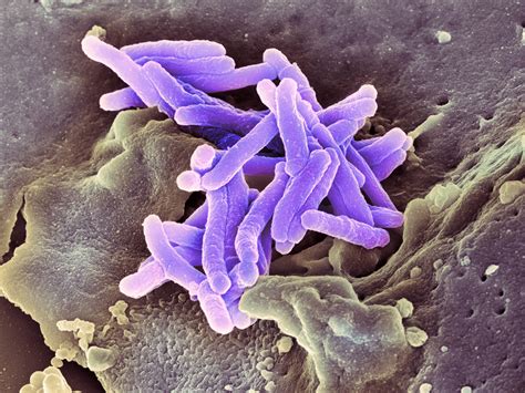 Tuberculosis Bacteria