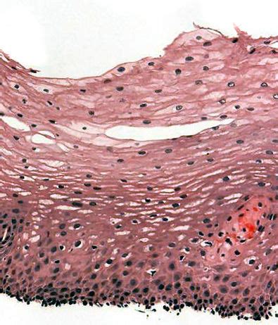 Epitelio escamoso estratificado - Wikipedia, la enciclopedia libre Wiki ...