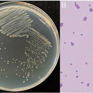 (PDF) First Report of Pediococcus acidilactici: Bacterium Harbored in ...