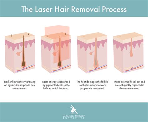 Laser Hair Removal | Palm Desert | Cosmetic Surgery Institute