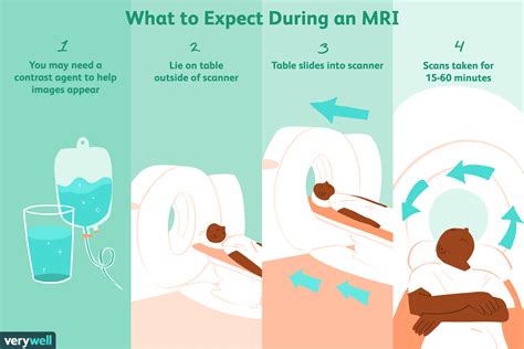 Mri Scan Diagram