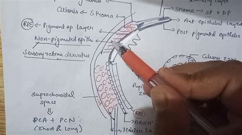 Uveal tract (clinical anatomy )simplified - YouTube