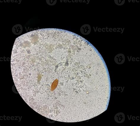 Eggs of Trichuris trichiura whipworm in stool, analyze by microscope ...