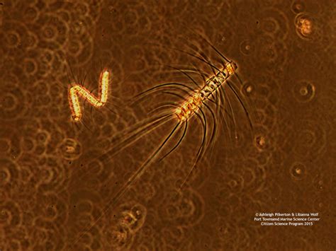 Microscope World Blog: Plankton (Chaetoceros) under the Microscope