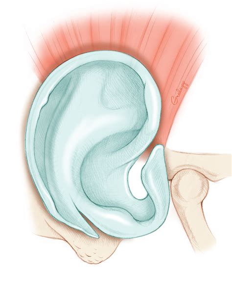 External Ear – Oto Surgery Atlas