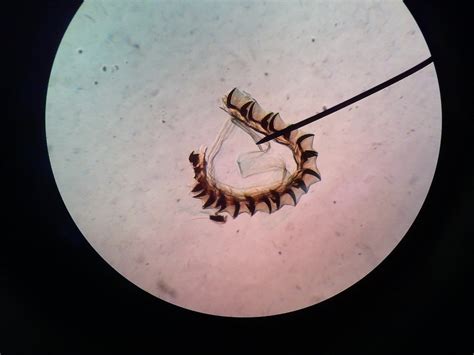 Radula (prepared slide) Diagram | Quizlet