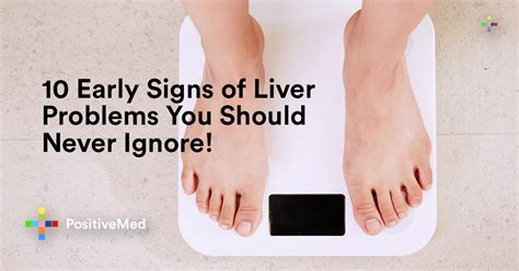 10 Early Signs of Liver Problems You Should Never Ignore