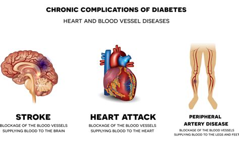 Chronic complications of Diabetes. Heart and blood vessel diseases ...