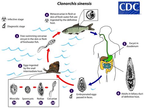 Clonorchiasis, clonorchis sinensis infection symptoms, diagnosis ...