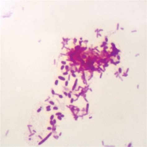 Amazon.com: Pseudomonas aeruginosa, w.m. Microscope Slide: Industrial ...