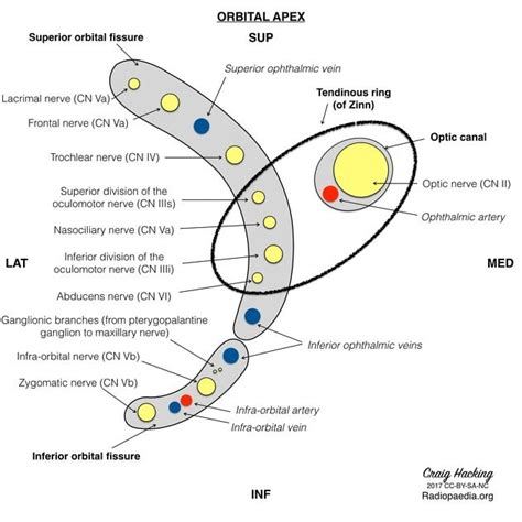 Superior orbital fissure (mnemonic) | Radiology Reference Article ...