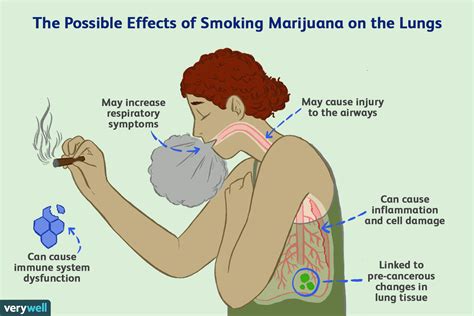 Est-ce que fumer de la marijuana cause le cancer du poumon ? - Fmedic