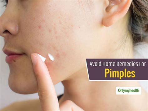 Avoid Any Random Home Remedy For Acne and Pimples, Seek These ...