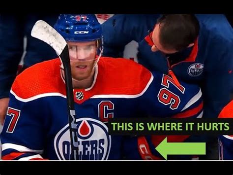 CONNOR MCDAVID Injury - Dr. Wilson reacts - YouTube