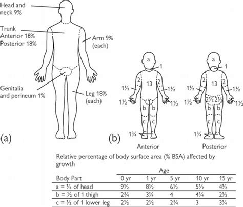 Major Burns in Children | Pediatric Emergency Playbook