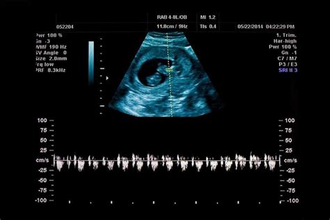 A Brief Guide To Ultrasound Procedure!