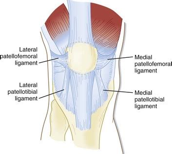 Medial Patellofemoral Ligament (MPFL) Reconstruction | Knee Surgery ...