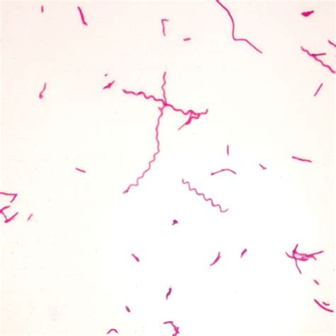 Typical Spirillum Bacteria Microscope Slides, w.m. | Carolina ...