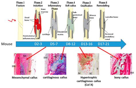 A representative figure showing the different murine fracture healing ...