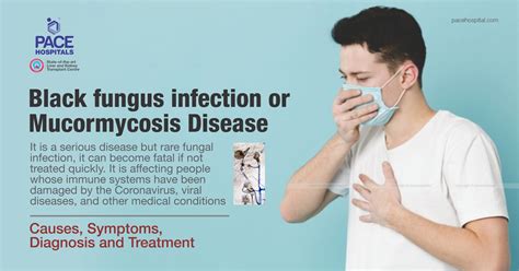 Black Fungus Infection Mucormycosis Disease: Symptoms & Treatment