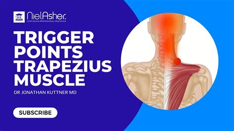 Trapezius - How To Find Trigger Points - YouTube