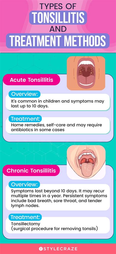 Tonsillitis Treatment