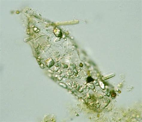 Protist Images: Difflugia acuminata