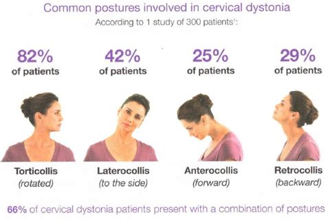 Dystonia