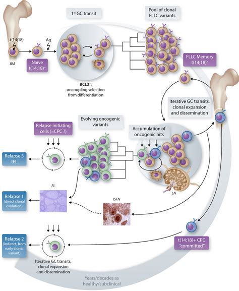 The current model of FL development. Follicular lymphoma biological ...