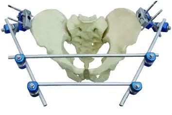 Pelvic External Fixator Orthopedic External Fixation - Buy Pelvic ...