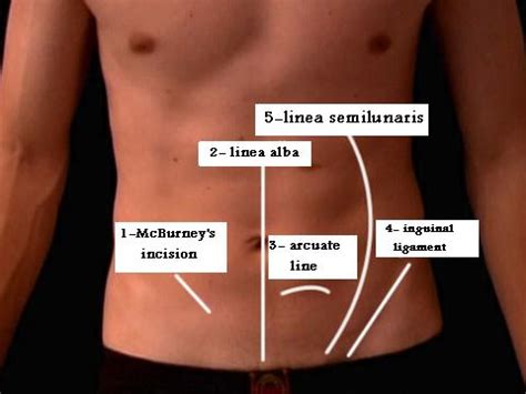 Medi Photos: Lines on anterior Abdominal Wall