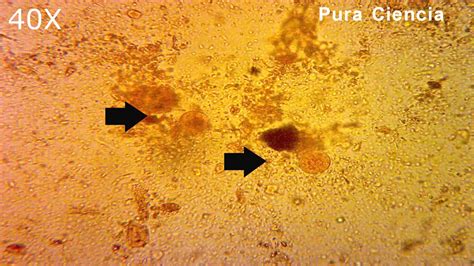 Entamoeba Coli Under Microscope