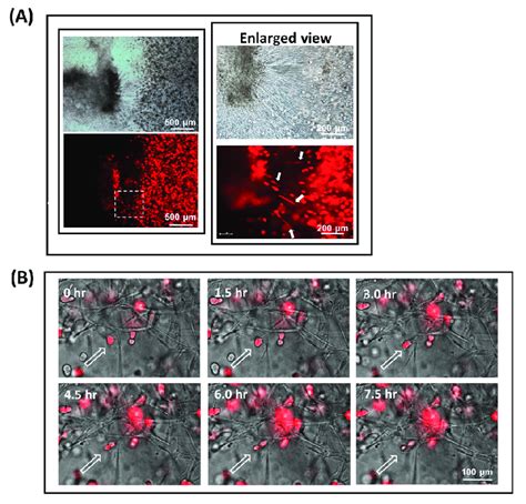 Fibroblast-guided cancer cell migration as viewed from the invasion ...