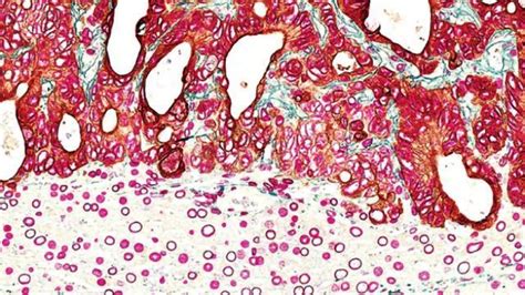 Immunohistochemistry Guide | Technology Networks