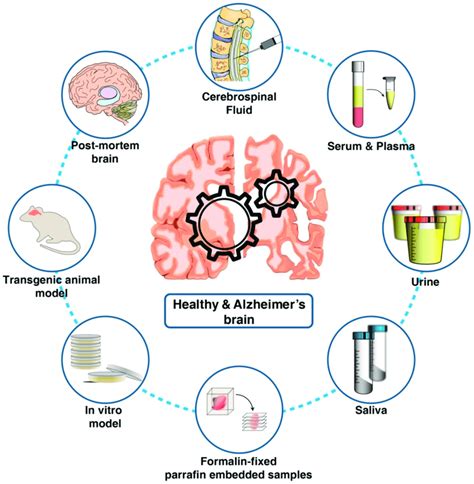 Biological materials used for understanding Alzheimer's pathology and ...