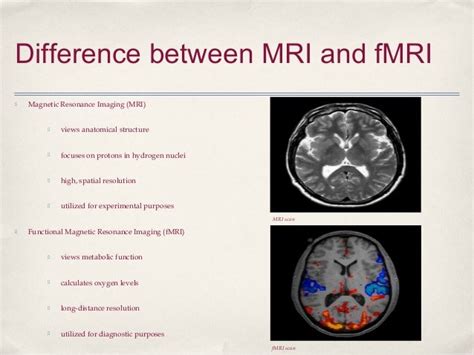 MRI Presentation Final