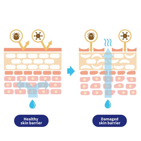 Picky Guide: All About Skin Barrier - Picky | The K-Beauty Hot Place