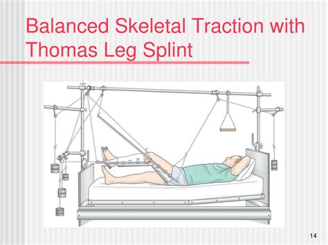 Skeletal Traction